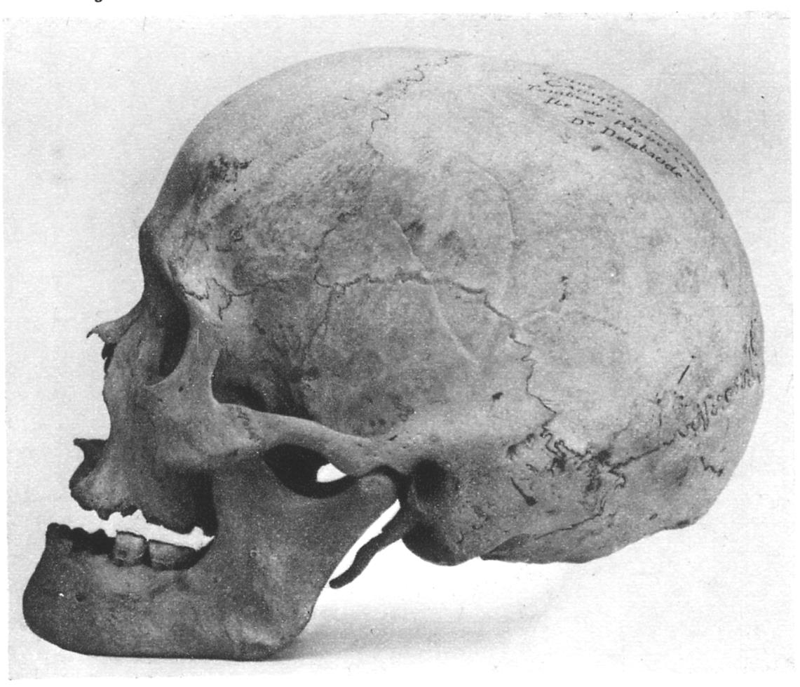 Lower Skull